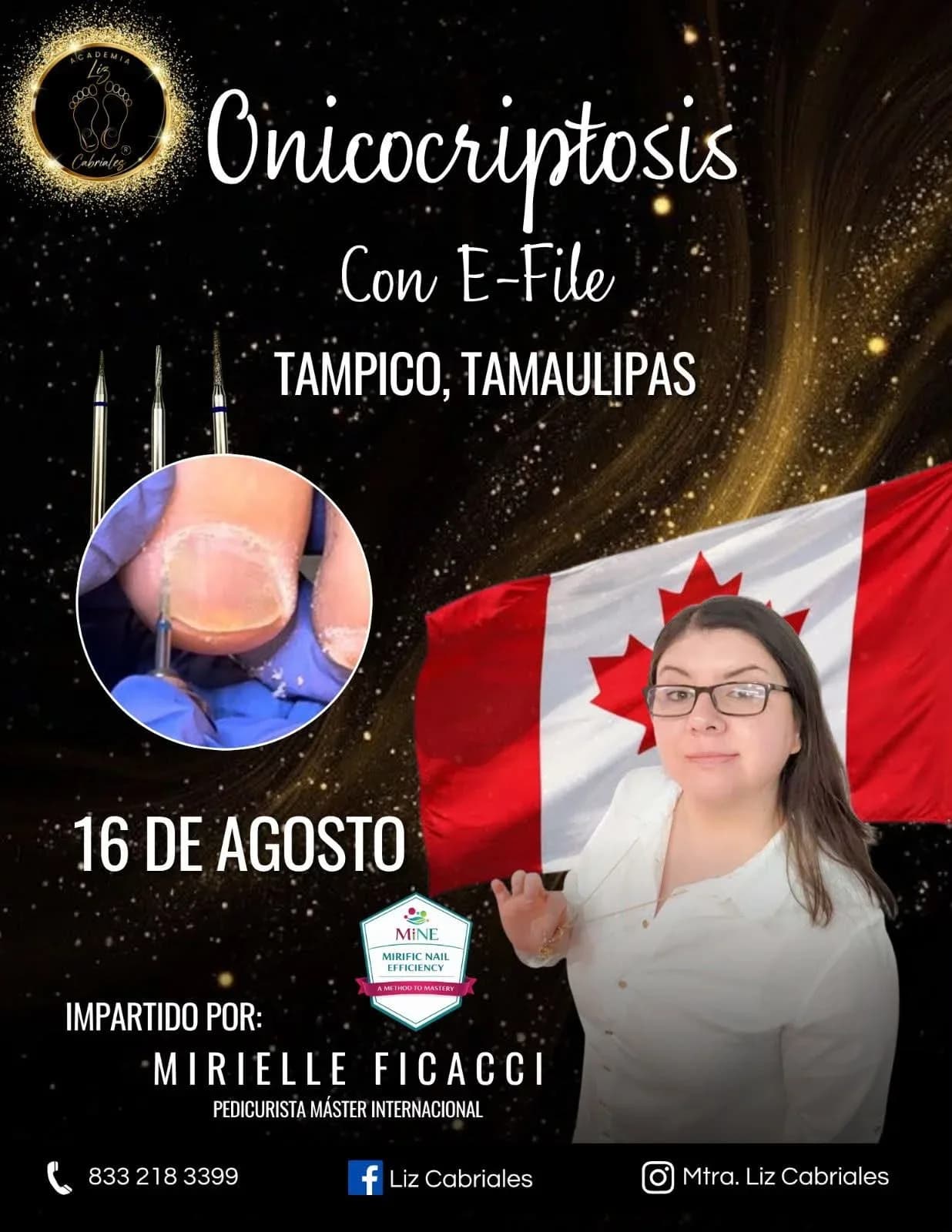 Onicocriptosis con E-File.